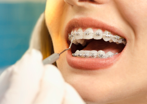 Orthodontics los angeles